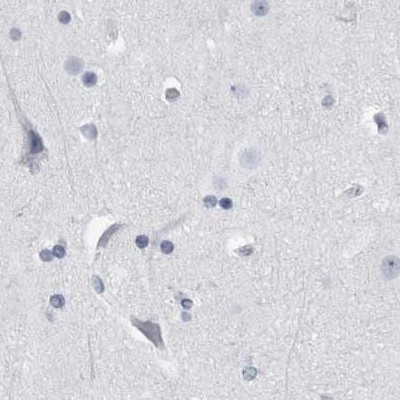 ALDH8A1 Antibody in Immunohistochemistry (IHC)