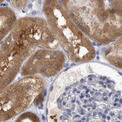 ALDH8A1 Antibody in Immunohistochemistry (IHC)