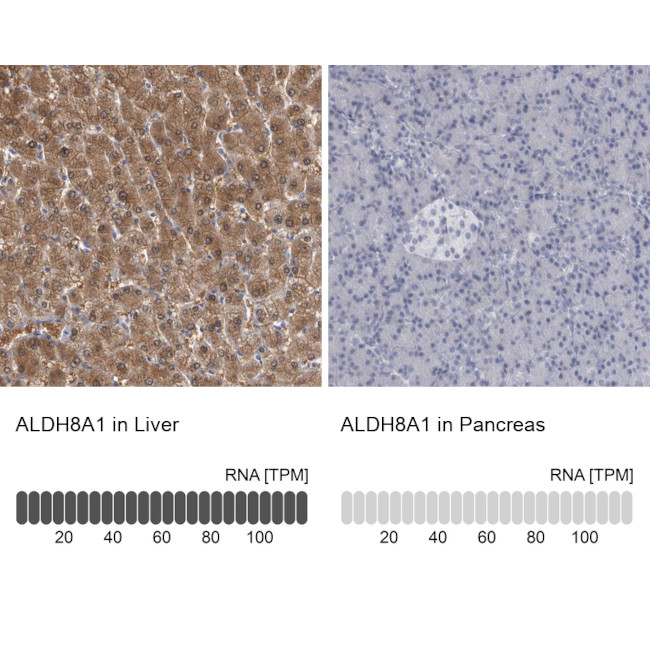 ALDH8A1 Antibody