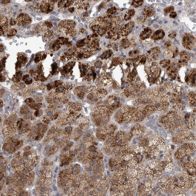 RAB29 Antibody in Immunohistochemistry (IHC)