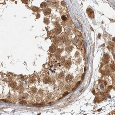 CAMSAP2 Antibody in Immunohistochemistry (IHC)