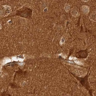 CAMSAP2 Antibody in Immunohistochemistry (IHC)