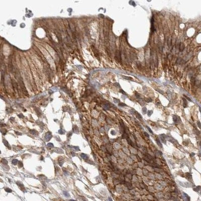 CAMSAP2 Antibody in Immunohistochemistry (IHC)