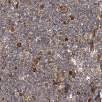 CAMSAP2 Antibody in Immunohistochemistry (IHC)