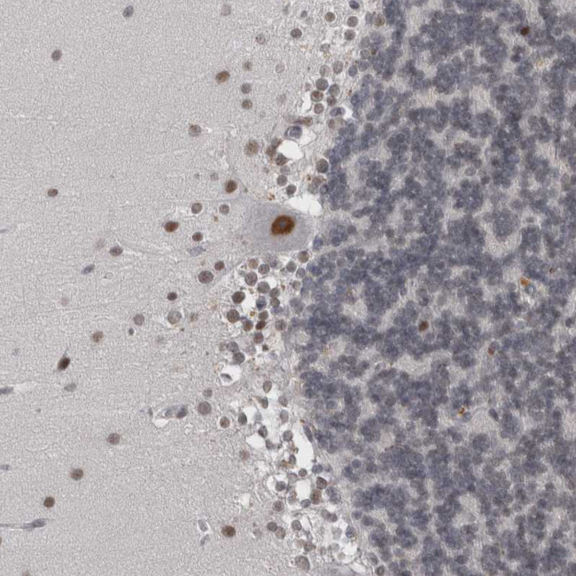 PSMB2 Antibody in Immunohistochemistry (IHC)