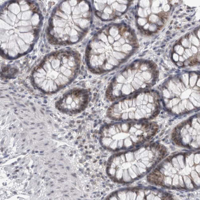 PSMB2 Antibody in Immunohistochemistry (IHC)