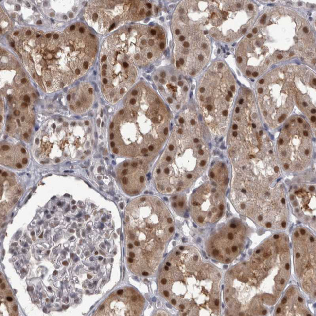 PSMB2 Antibody in Immunohistochemistry (IHC)