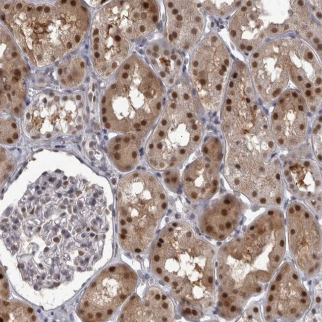 PSMB2 Antibody in Immunohistochemistry (IHC)