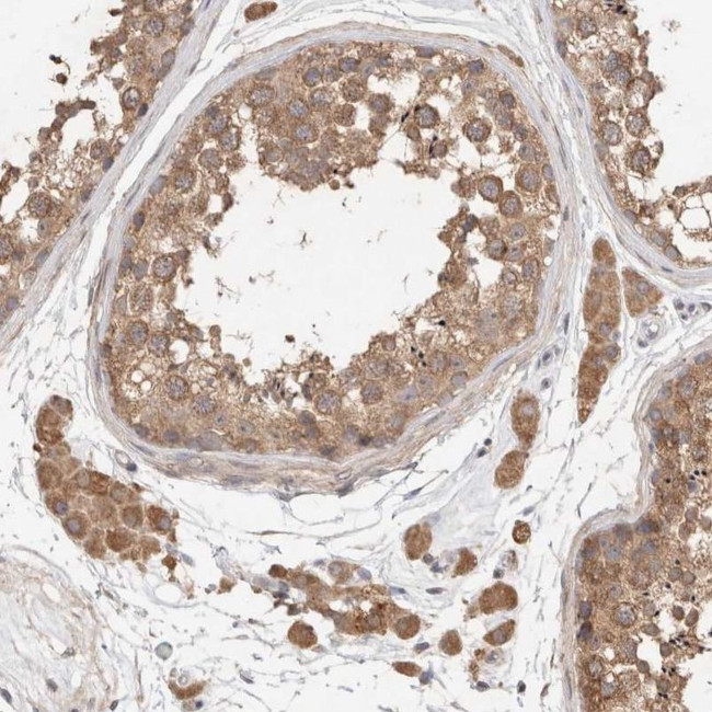 RAB14 Antibody in Immunohistochemistry (IHC)