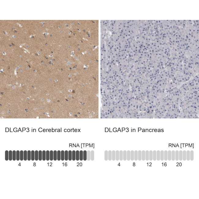 SAPAP3 Antibody in Immunohistochemistry (IHC)