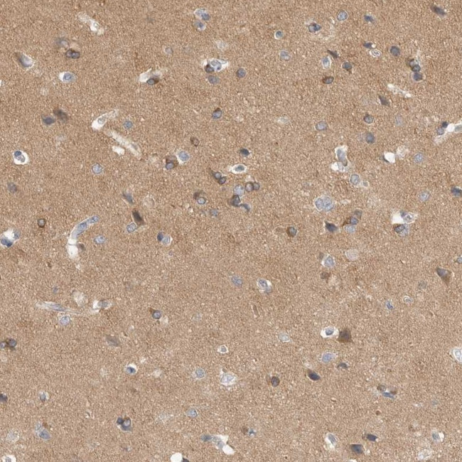 SAPAP3 Antibody in Immunohistochemistry (IHC)