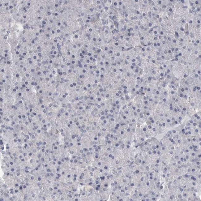 SAPAP3 Antibody in Immunohistochemistry (IHC)