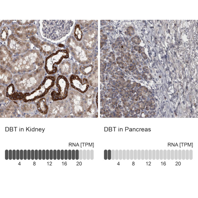 DBT Antibody in Immunohistochemistry (IHC)