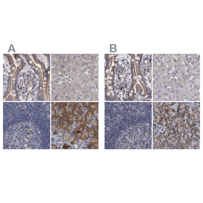 DBT Antibody in Immunohistochemistry (IHC)