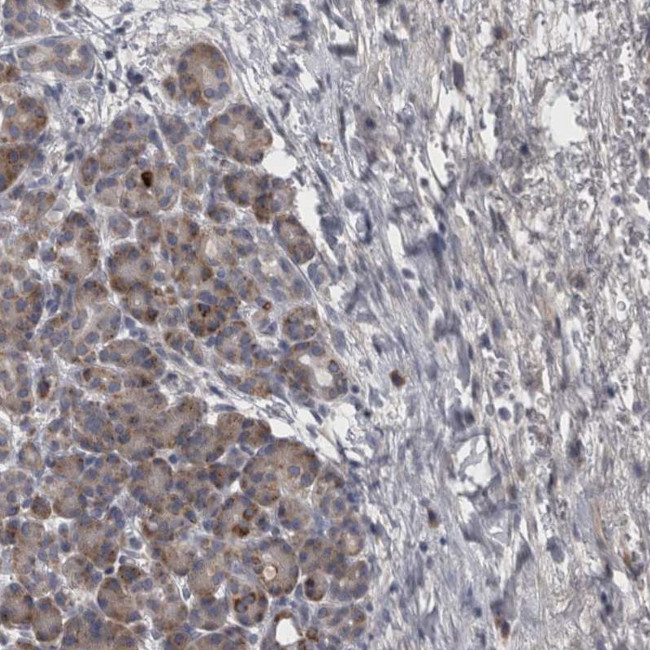 DBT Antibody in Immunohistochemistry (IHC)