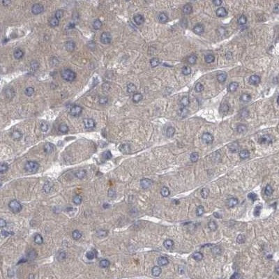 DBT Antibody in Immunohistochemistry (IHC)