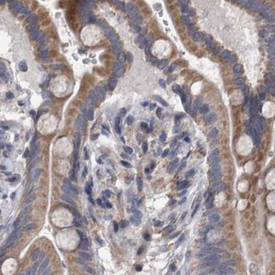 DBT Antibody in Immunohistochemistry (IHC)