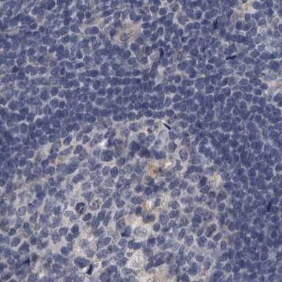 DBT Antibody in Immunohistochemistry (IHC)