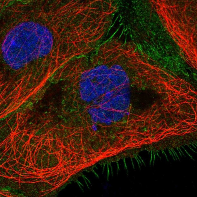 C1QBP Antibody in Immunocytochemistry (ICC/IF)