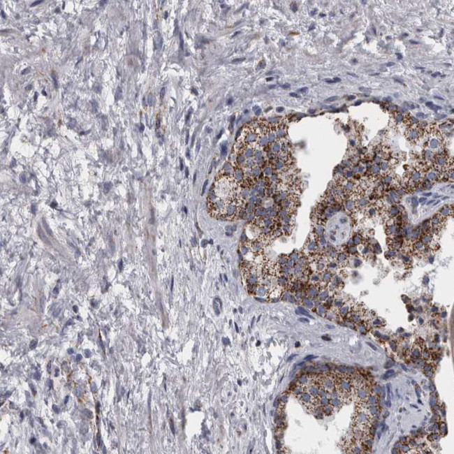 DBT Antibody in Immunohistochemistry (IHC)