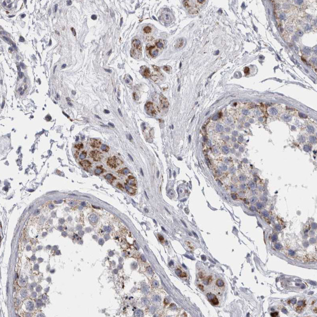 DBT Antibody in Immunohistochemistry (IHC)