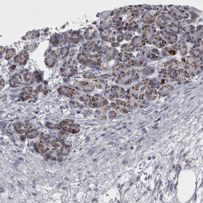 DBT Antibody in Immunohistochemistry (IHC)