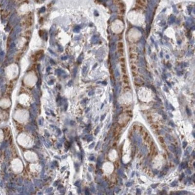 DBT Antibody in Immunohistochemistry (IHC)