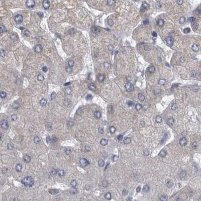 DBT Antibody in Immunohistochemistry (IHC)