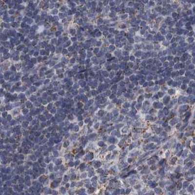 DBT Antibody in Immunohistochemistry (IHC)