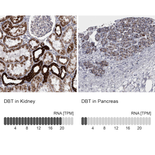 DBT Antibody