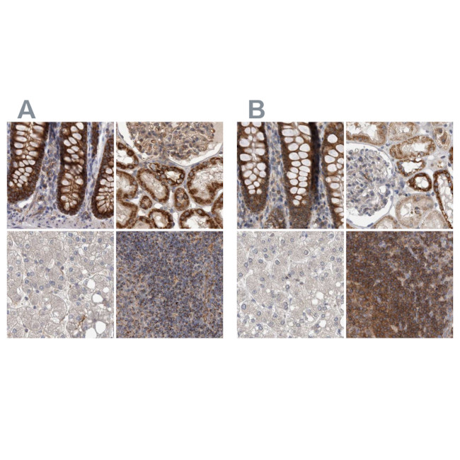 AspRS Antibody in Immunohistochemistry (IHC)