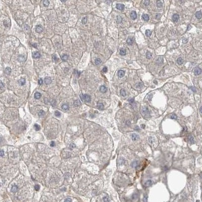 AspRS Antibody in Immunohistochemistry (IHC)