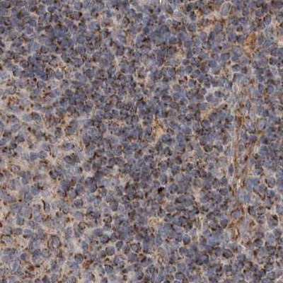 AspRS Antibody in Immunohistochemistry (IHC)