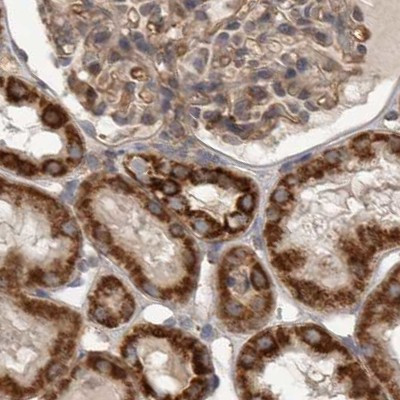 AspRS Antibody in Immunohistochemistry (IHC)