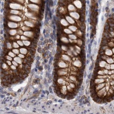 AspRS Antibody in Immunohistochemistry (IHC)