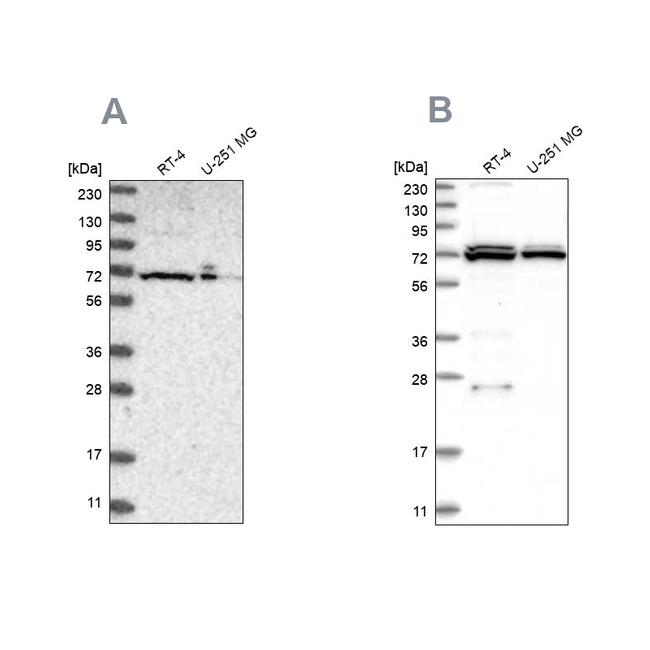 AspRS Antibody in Western Blot (WB)