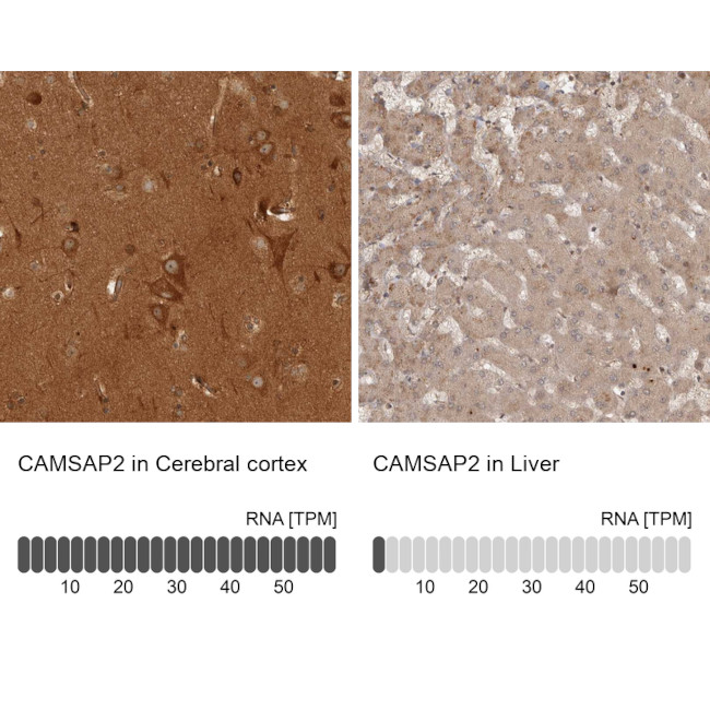 CAMSAP2 Antibody in Immunohistochemistry (IHC)