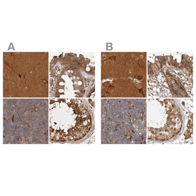 CAMSAP2 Antibody in Immunohistochemistry (IHC)