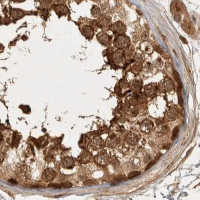 CAMSAP2 Antibody in Immunohistochemistry (IHC)