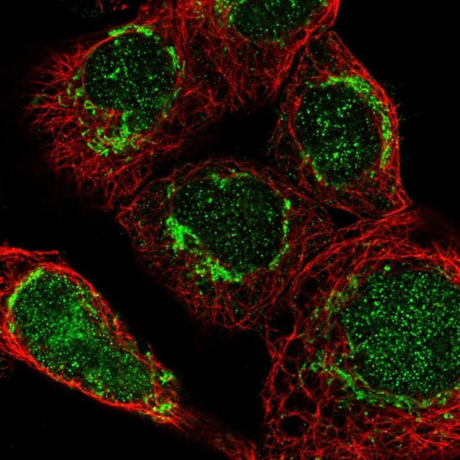 AspRS Antibody in Immunocytochemistry (ICC/IF)