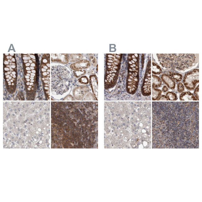 AspRS Antibody in Immunohistochemistry (IHC)