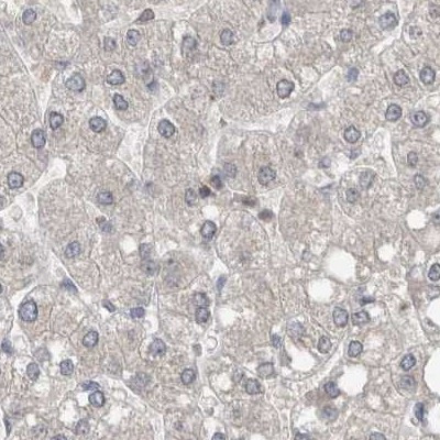 AspRS Antibody in Immunohistochemistry (IHC)