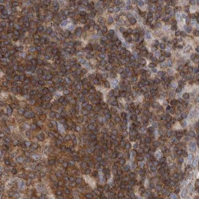 AspRS Antibody in Immunohistochemistry (IHC)