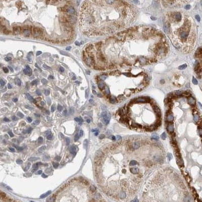 AspRS Antibody in Immunohistochemistry (IHC)