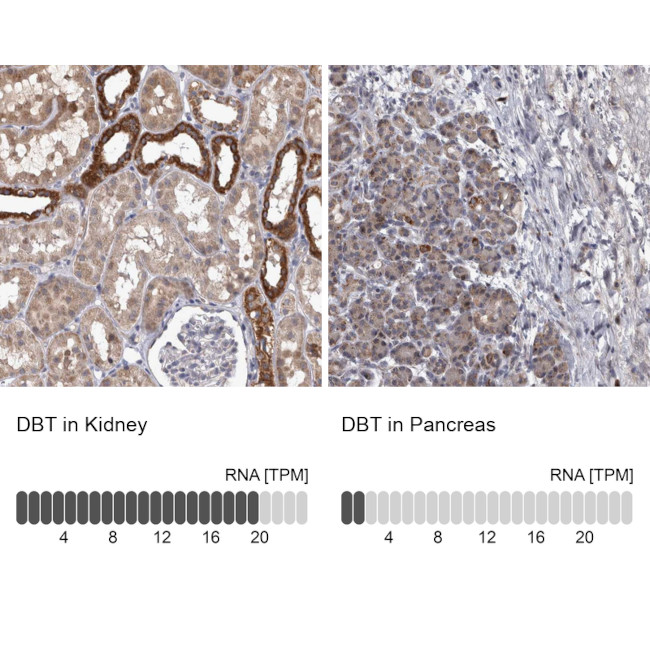 DBT Antibody in Immunohistochemistry (IHC)