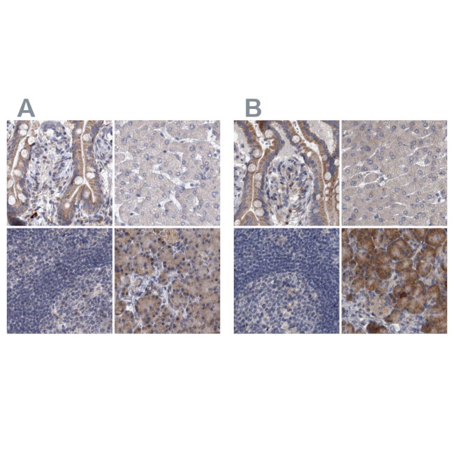 DBT Antibody in Immunohistochemistry (IHC)