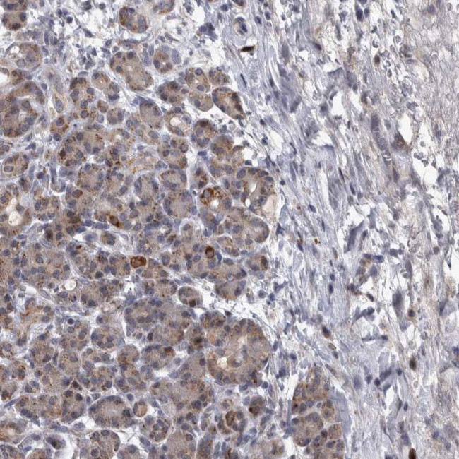 DBT Antibody in Immunohistochemistry (IHC)