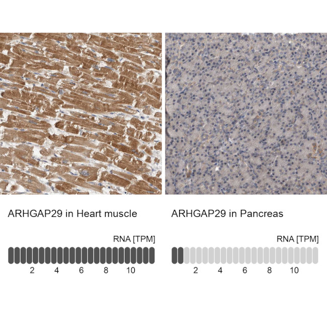 PARG1 Antibody in Immunohistochemistry (IHC)