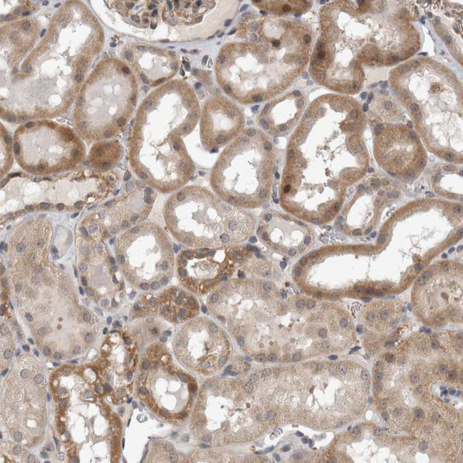 PARG1 Antibody in Immunohistochemistry (IHC)