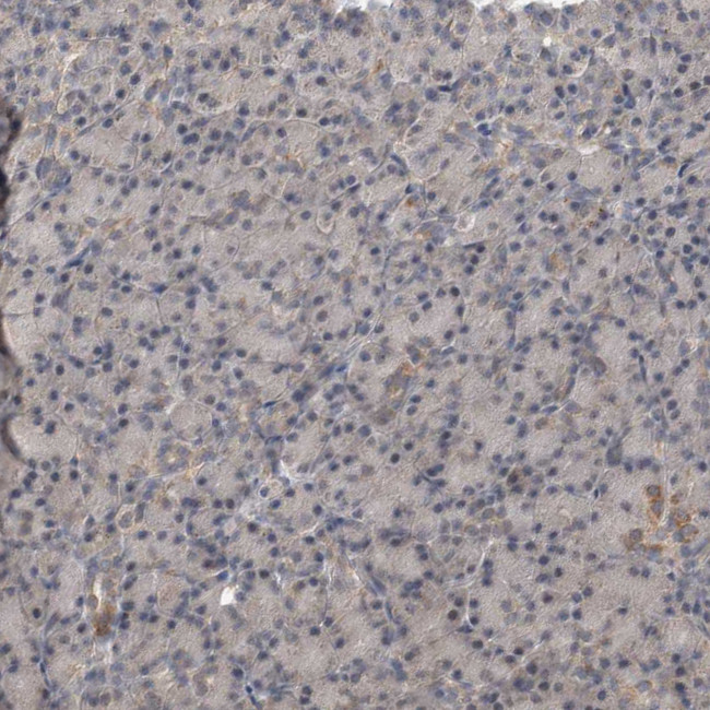 PARG1 Antibody in Immunohistochemistry (IHC)